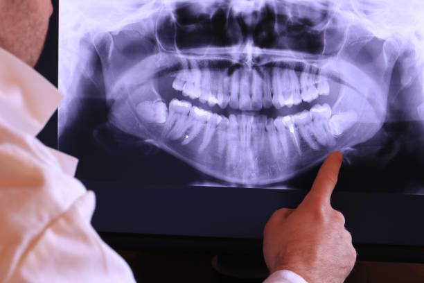 Best Emergency Dentist for Knocked-Out Tooth in Socorro, TX