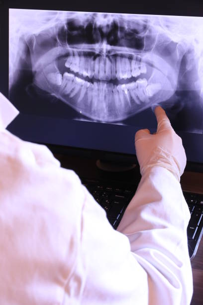 Best Emergency Root Canal Treatment in Socorro, TX