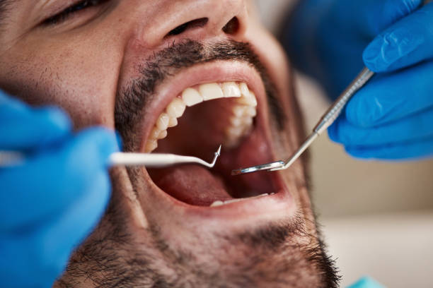 Best Emergency Dental Care for Abscessed Tooth in Socorro, TX